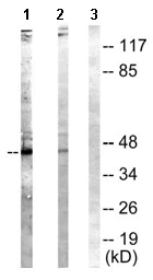 Western blot - Anti-NCF1/p47-phox (phospho S304) antibody (AB63554)