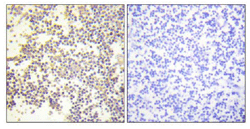 Immunohistochemistry (Formalin/PFA-fixed paraffin-embedded sections) - Anti-NCF1/p47-phox (phospho S328) antibody (AB111855), expandable thumbnail
