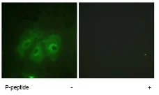 Immunocytochemistry/ Immunofluorescence - Anti-NCF1/p47-phox (phospho S359) antibody (AB74095)