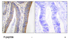 Immunohistochemistry (Formalin/PFA-fixed paraffin-embedded sections) - Anti-NCF1/p47-phox (phospho S359) antibody (AB74095)