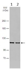 Western blot - Anti-NCKAP1 antibody (AB126061)