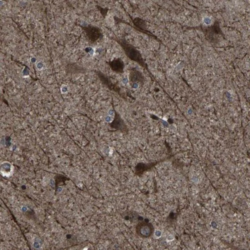 Immunohistochemistry (Formalin/PFA-fixed paraffin-embedded sections) - Anti-NCKAP1 antibody (AB244383)