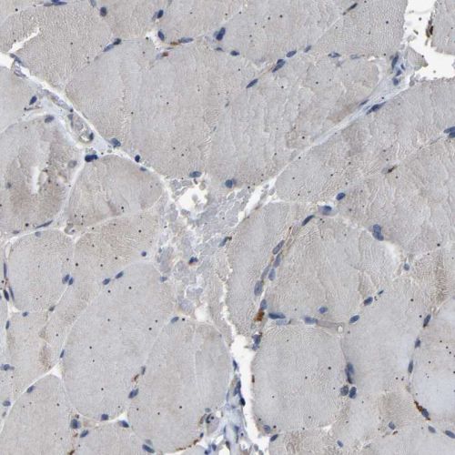 Immunohistochemistry (Formalin/PFA-fixed paraffin-embedded sections) - Anti-NCKAP1 antibody (AB244383)