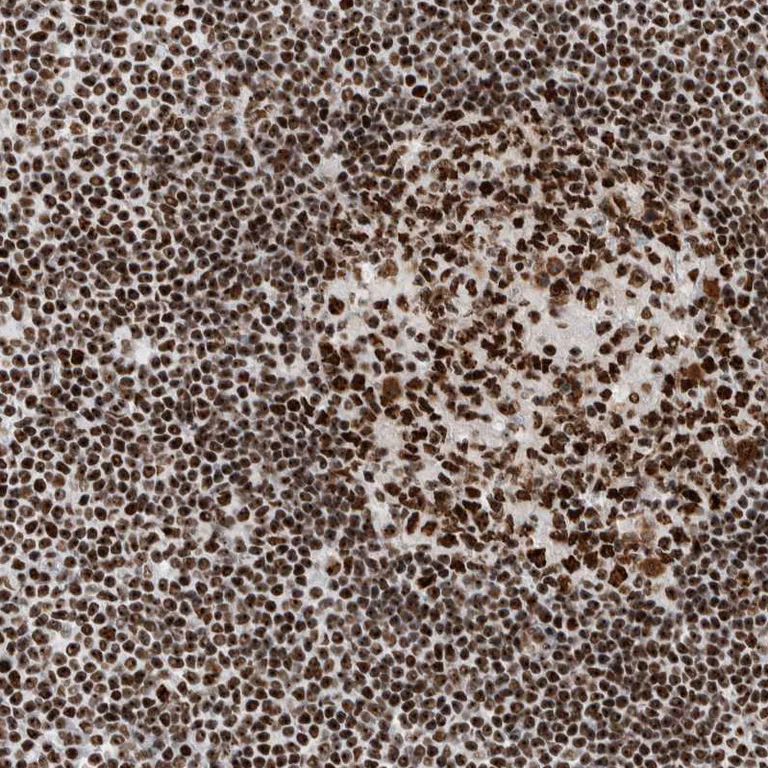 Immunohistochemistry (Formalin/PFA-fixed paraffin-embedded sections) - Anti-NCL Antibody (AB327202)