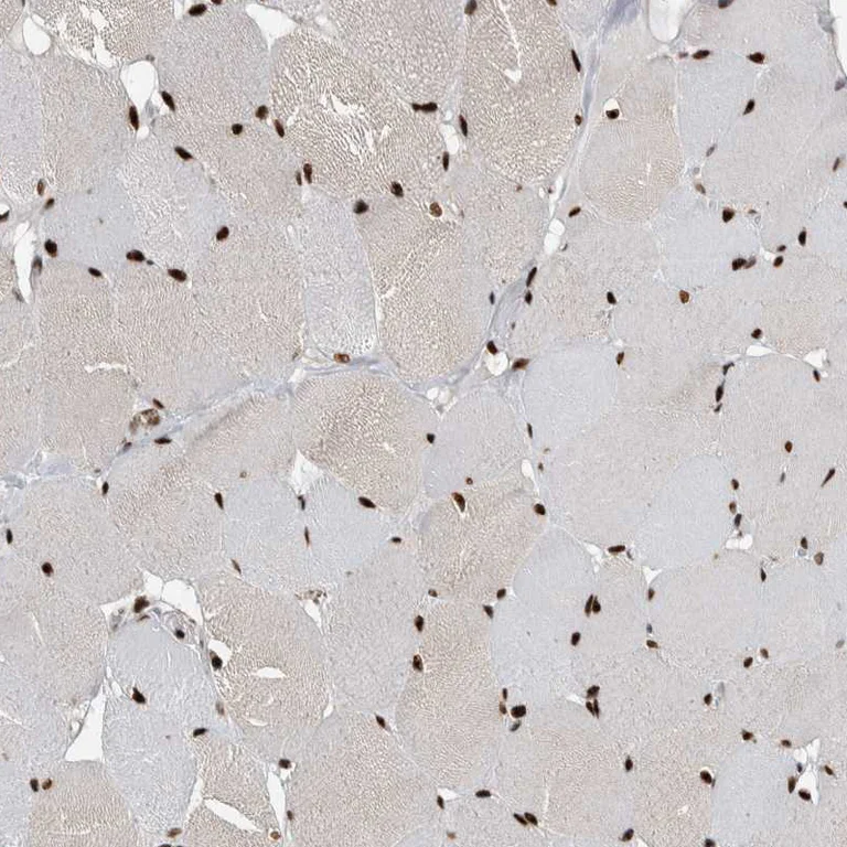 Immunohistochemistry (Formalin/PFA-fixed paraffin-embedded sections) - Anti-NCL Antibody (AB327202)