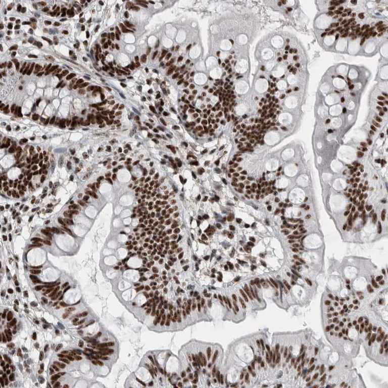 Immunohistochemistry (Formalin/PFA-fixed paraffin-embedded sections) - Anti-NCL Antibody (AB327202)