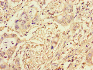 Immunohistochemistry (Formalin/PFA-fixed paraffin-embedded sections) - Anti-NCM antibody (AB234709)