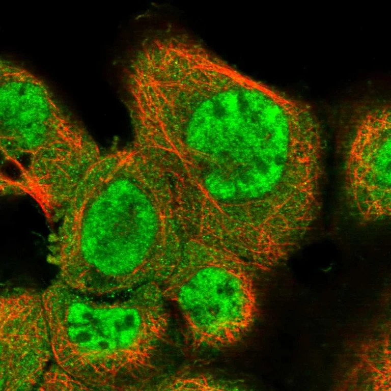 Immunocytochemistry/ Immunofluorescence - Anti-NCOA3 Antibody (AB327204)