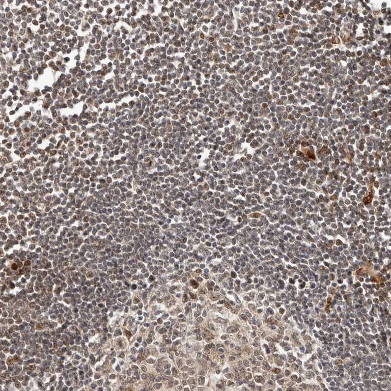 Immunohistochemistry (Formalin/PFA-fixed paraffin-embedded sections) - Anti-NCOA3 Antibody (AB327204)