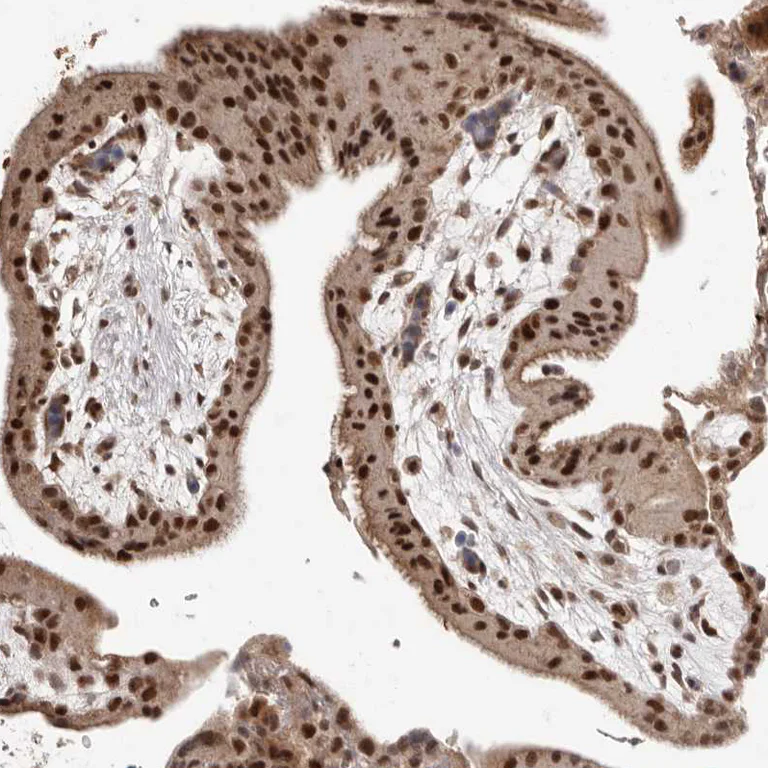 Immunohistochemistry (Formalin/PFA-fixed paraffin-embedded sections) - Anti-NCOA3 Antibody (AB327204)