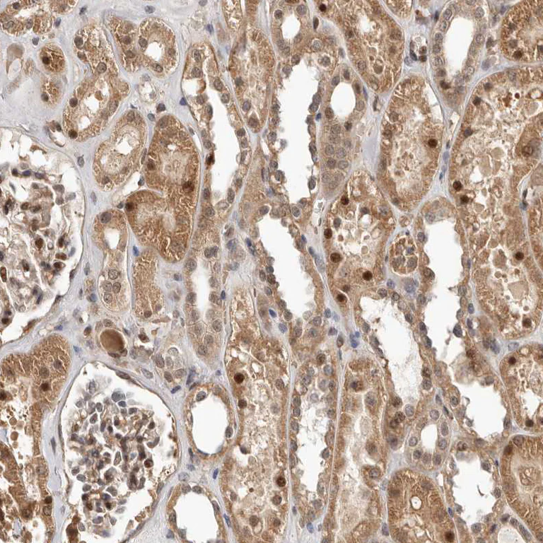 Immunohistochemistry (Formalin/PFA-fixed paraffin-embedded sections) - Anti-NCOA3 Antibody (AB327204)