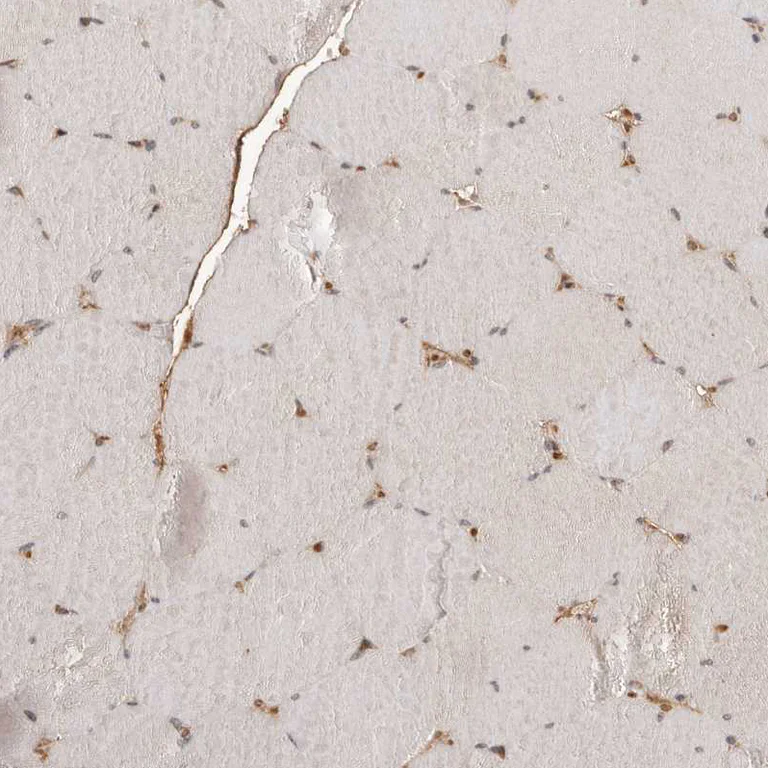 Immunohistochemistry (Formalin/PFA-fixed paraffin-embedded sections) - Anti-NCOA3 Antibody (AB327204)