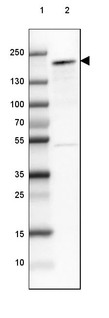Western blot - Anti-NCOA3 Antibody (AB327204)