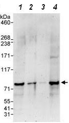 Western blot - Anti-NCOA4 antibody (AB86707)