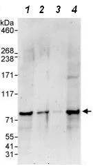 Western blot - Anti-NCOA4 antibody (AB86707)