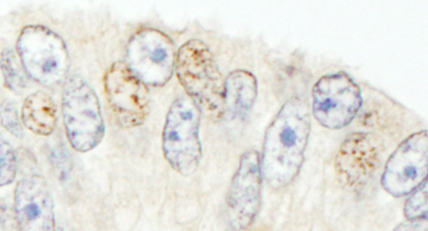 Immunohistochemistry (Formalin/PFA-fixed paraffin-embedded sections) - Anti-NCOA62/SNW1 antibody (AB70827)