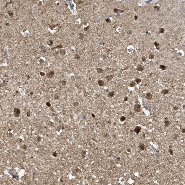 Immunohistochemistry (Formalin/PFA-fixed paraffin-embedded sections) - Anti-NCOA7 antibody (AB254732)