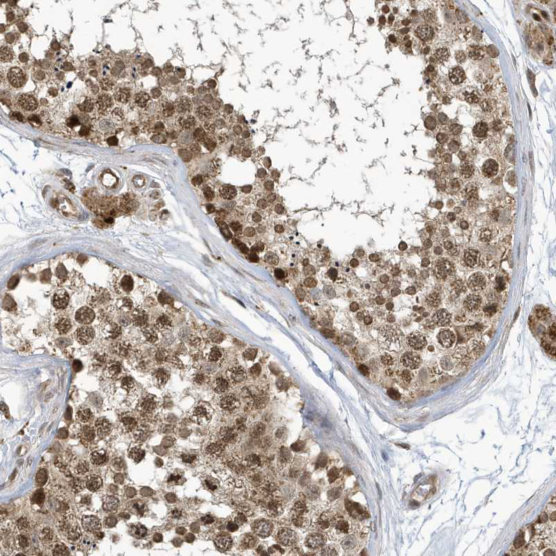 Immunohistochemistry (Formalin/PFA-fixed paraffin-embedded sections) - Anti-NCOA7 antibody (AB254732)