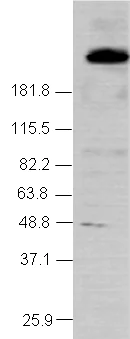 Western blot - Anti-NCOR2/SMRT antibody (AB24551)