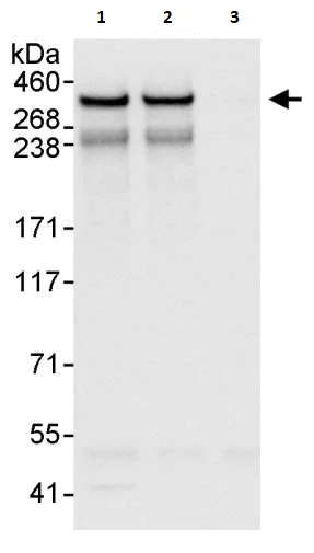 Immunoprecipitation - Anti-NCOR2/SMRT antibody (AB264188)