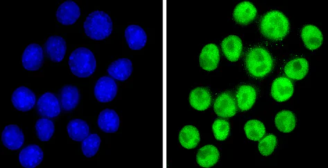 Immunocytochemistry/ Immunofluorescence - Anti-NCOR2/SMRT antibody (AB5802)