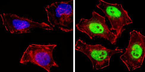 Immunocytochemistry/ Immunofluorescence - Anti-NCOR2/SMRT antibody (AB5802), expandable thumbnail