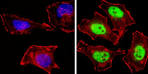 Immunocytochemistry/ Immunofluorescence - Anti-NCOR2/SMRT antibody (AB5802)