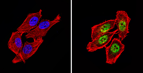 Immunocytochemistry/ Immunofluorescence - Anti-NCOR2/SMRT antibody (AB5802), expandable thumbnail