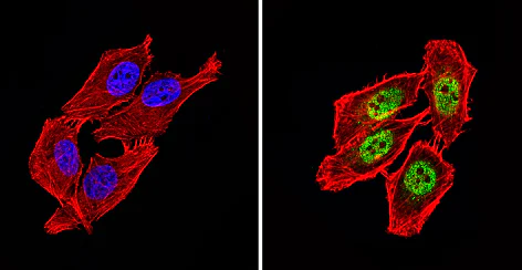 Immunocytochemistry/ Immunofluorescence - Anti-NCOR2/SMRT antibody (AB5802)