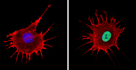 Immunocytochemistry/ Immunofluorescence - Anti-NCOR2/SMRT antibody (AB5802), expandable thumbnail
