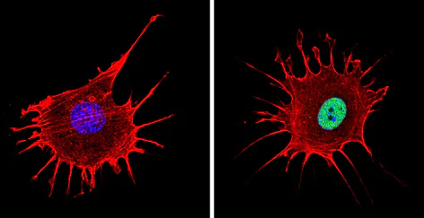 Immunocytochemistry/ Immunofluorescence - Anti-NCOR2/SMRT antibody (AB5802)