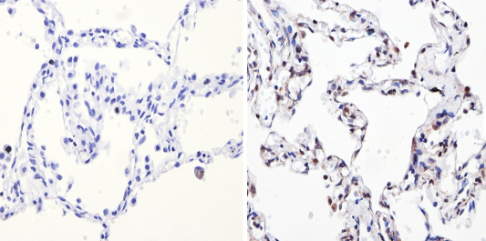 Immunohistochemistry (Formalin/PFA-fixed paraffin-embedded sections) - Anti-NCOR2/SMRT antibody (ab5802), expandable thumbnail