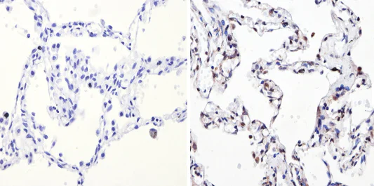 Immunohistochemistry (Formalin/PFA-fixed paraffin-embedded sections) - Anti-NCOR2/SMRT antibody (AB5802)