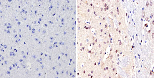 Immunohistochemistry (Formalin/PFA-fixed paraffin-embedded sections) - Anti-NCOR2/SMRT antibody (AB5802)