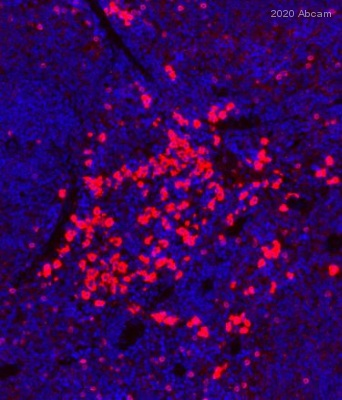 Immunohistochemistry (Formalin/PFA-fixed paraffin-embedded sections) - Anti-NCR1 antibody [EPR23097-35] (ab233558), expandable thumbnail