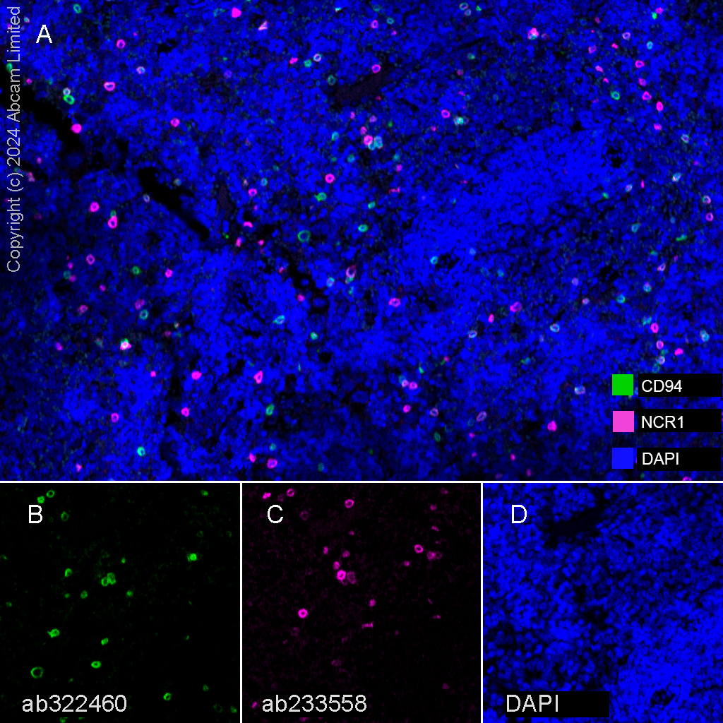 Multiplex immunohistochemistry - Anti-NCR1 antibody [EPR23097-35] (ab233558), expandable thumbnail