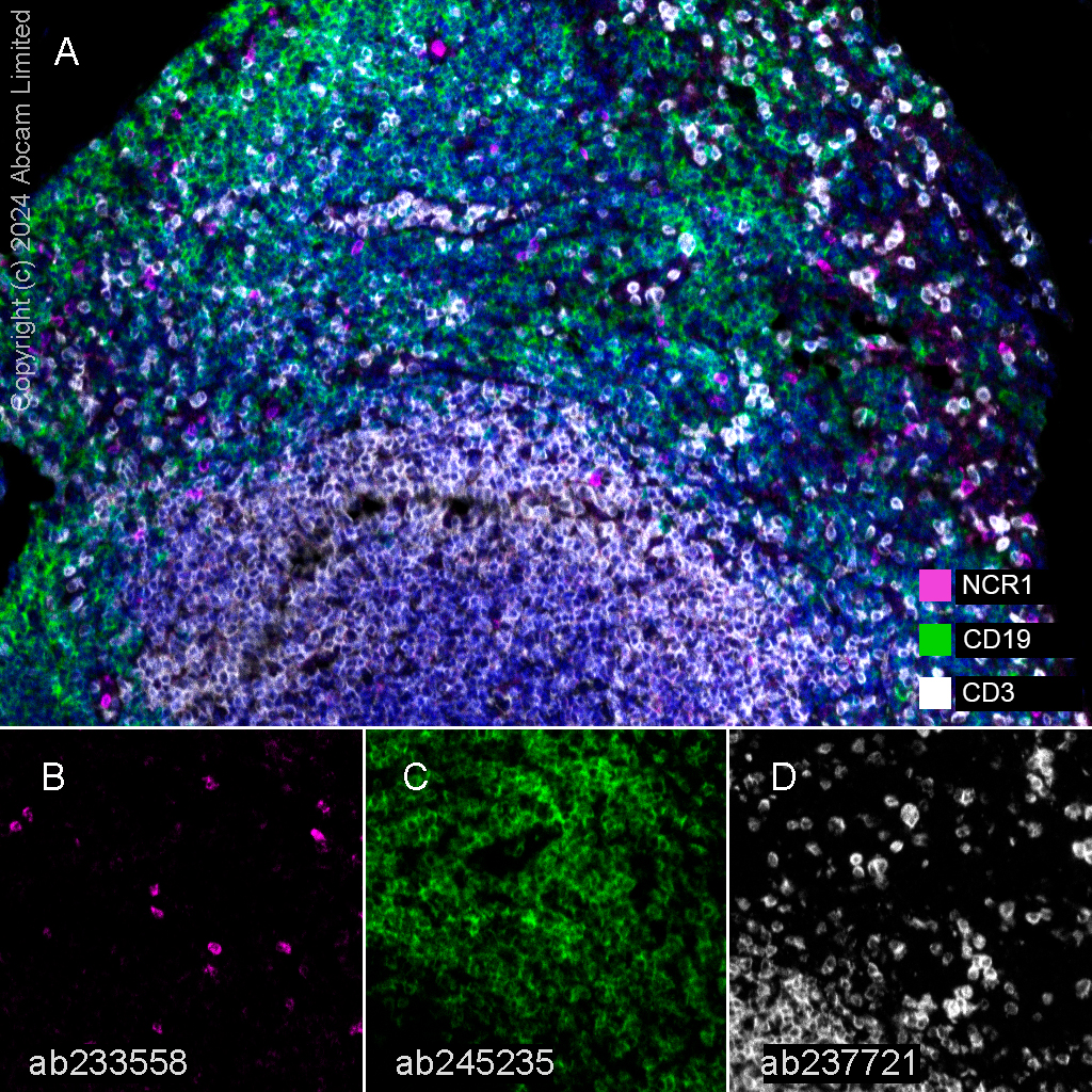 Multiplex immunohistochemistry - Anti-NCR1 antibody [EPR23097-35] (AB233558), expandable thumbnail