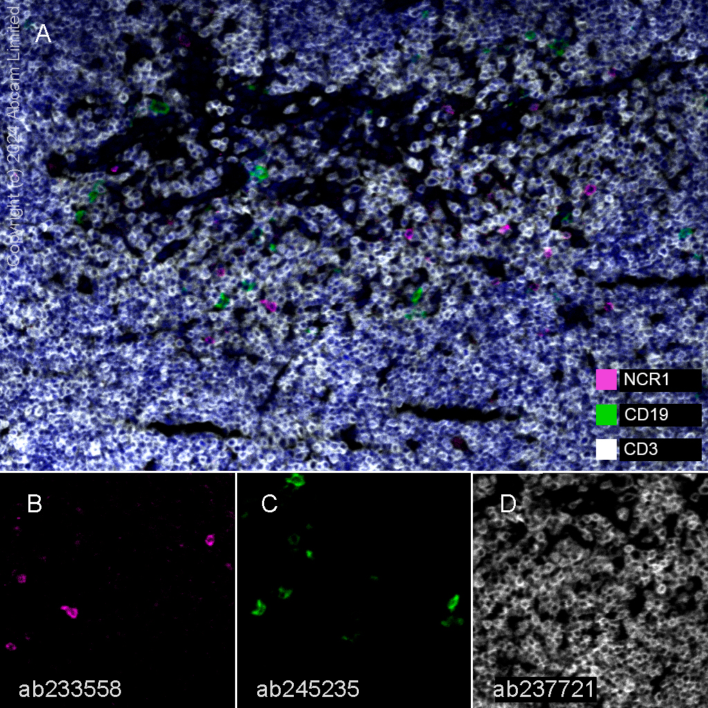 Multiplex immunohistochemistry - Anti-NCR1 antibody [EPR23097-35] (ab233558), expandable thumbnail