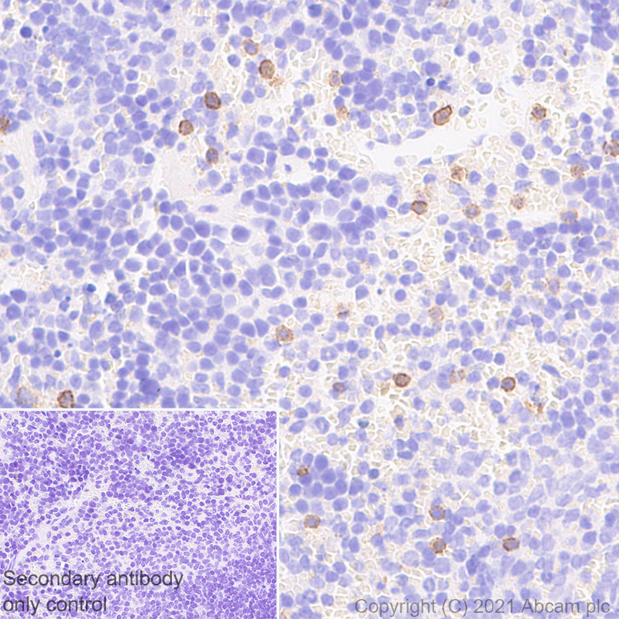 Immunohistochemistry (Formalin/PFA-fixed paraffin-embedded sections) - Anti-NCR1 antibody [mNCR1.05] - BSA and Azide free (AB283517), expandable thumbnail