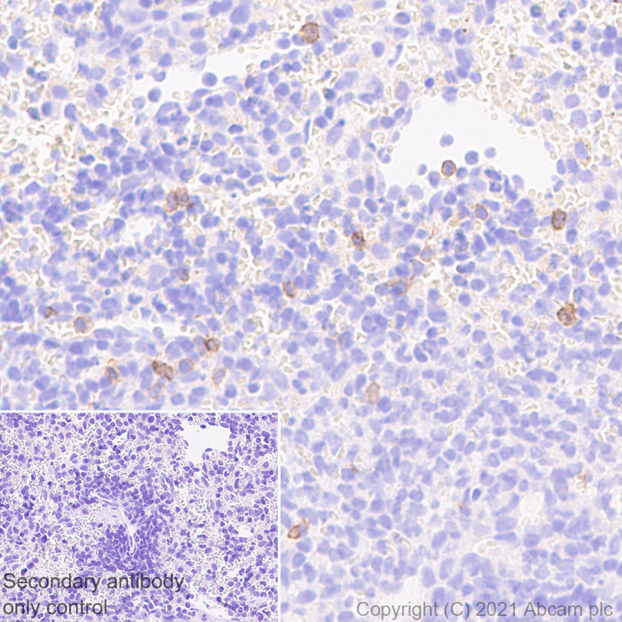 Immunohistochemistry (Formalin/PFA-fixed paraffin-embedded sections) - Anti-NCR1 antibody [mNCR1.05] - BSA and Azide free (AB283517), expandable thumbnail