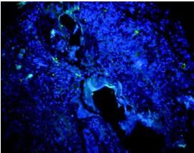 Immunohistochemistry (Formalin/PFA-fixed paraffin-embedded sections) - Anti-NCR1/NKp46 antibody (AB199128)