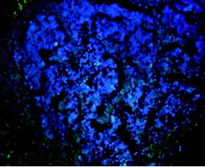 Immunohistochemistry (Formalin/PFA-fixed paraffin-embedded sections) - Anti-NCR1/NKp46 antibody (AB199128)