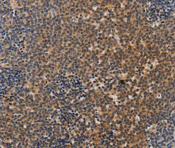 Immunohistochemistry (Formalin/PFA-fixed paraffin-embedded sections) - Anti-NCR1/NKp46 antibody (AB199128)