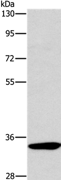 Western blot - Anti-NCR1/NKp46 antibody (AB199128)