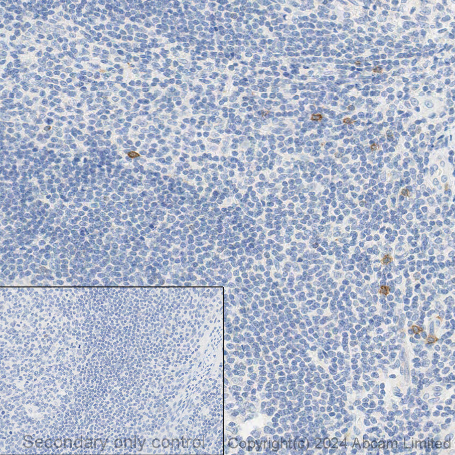 Immunohistochemistry (Formalin/PFA-fixed paraffin-embedded sections) - Anti-NCR1/NKp46 antibody [EPR22403-57] (AB224703)