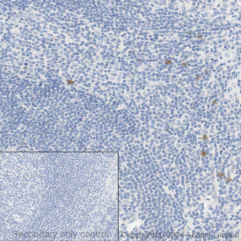 Immunohistochemistry (Formalin/PFA-fixed paraffin-embedded sections) - Anti-NCR1/NKp46 antibody [EPR22403-57] - BSA and Azide free (AB254209)