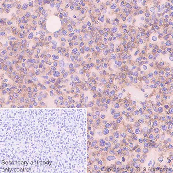 Immunohistochemistry (Formalin/PFA-fixed paraffin-embedded sections) - Anti-NCR1/NKp46 antibody [EPR22403-57] - BSA and Azide free (AB254209)