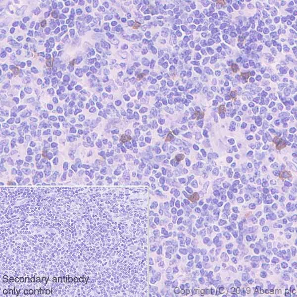 Immunohistochemistry (Formalin/PFA-fixed paraffin-embedded sections) - Anti-NCR1/NKp46 antibody [EPR22403-57] - BSA and Azide free (AB254209)