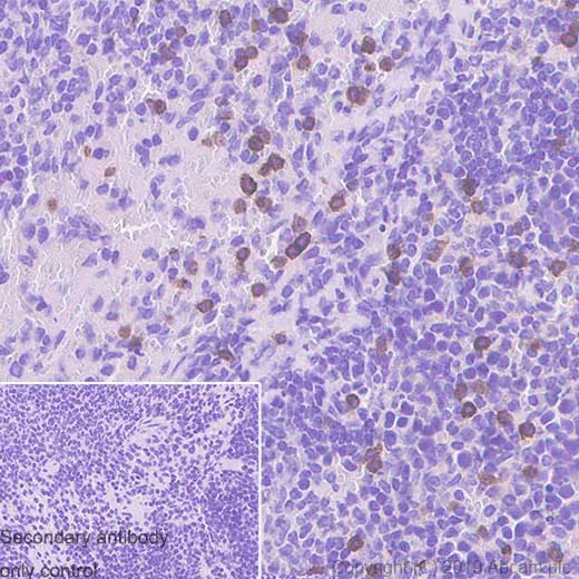 Immunohistochemistry (Formalin/PFA-fixed paraffin-embedded sections) - Anti-NCR1/NKp46 antibody [EPR23097-35] (AB233558)