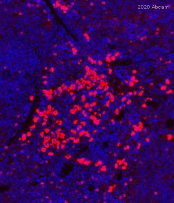 Immunohistochemistry (Formalin/PFA-fixed paraffin-embedded sections) - Anti-NCR1/NKp46 antibody [EPR23097-35] (AB233558)